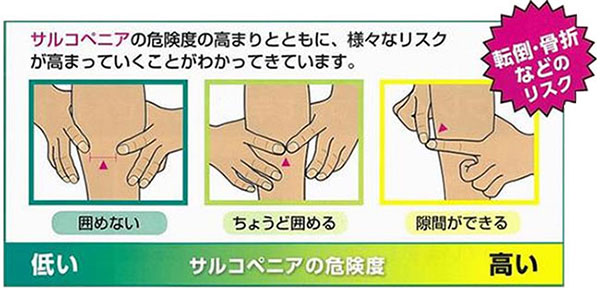 テスト結果　囲めない（危険度：低い）→ちょうど囲める→隙間ができる（危険度：高い）　サルコペニアの危険度の高まりとともに、様々なリスク（転倒・骨折など）が高まっていくことがわかってきています。